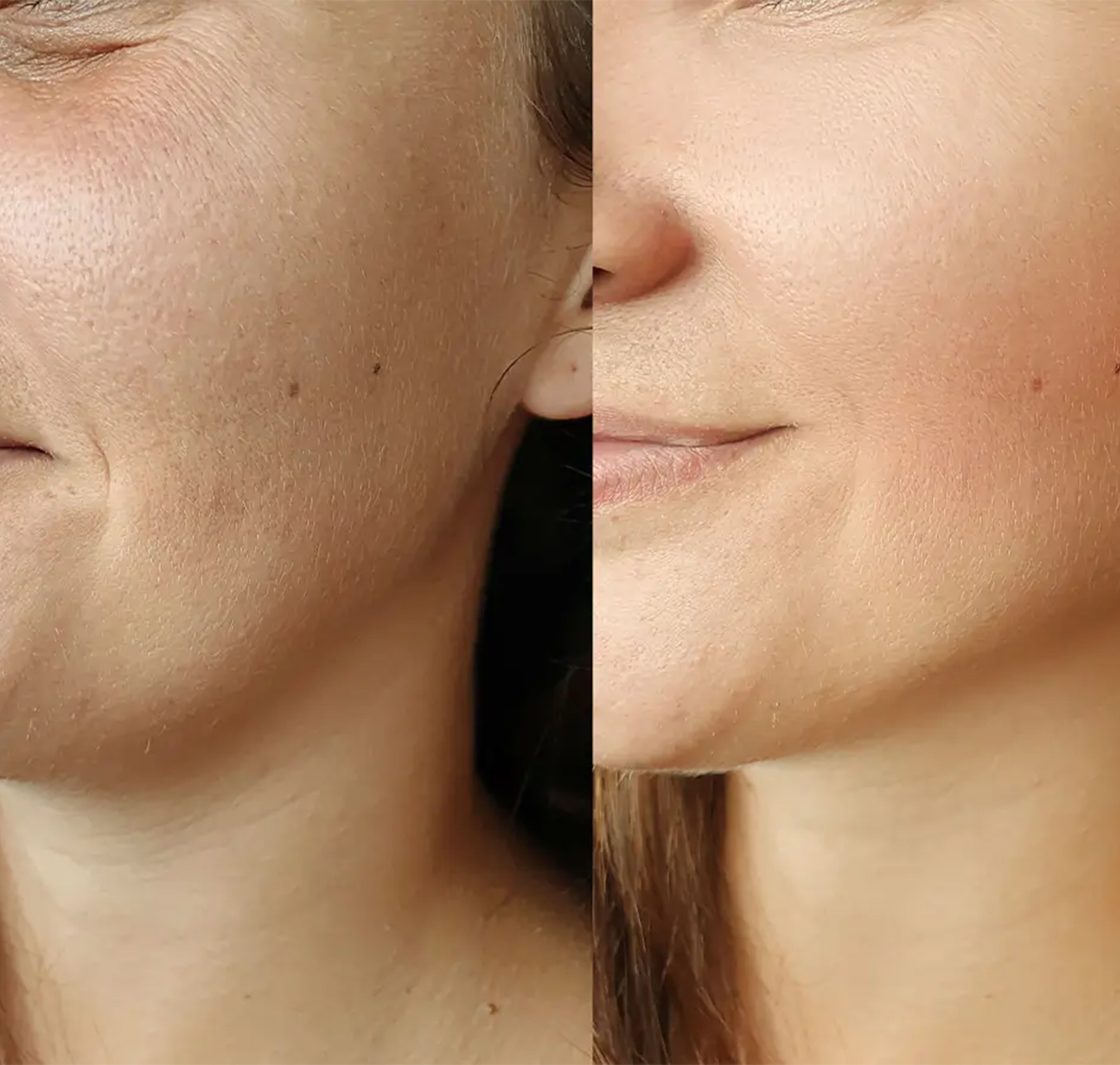 hands-on skin consultation