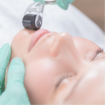 MICRONEEDLING