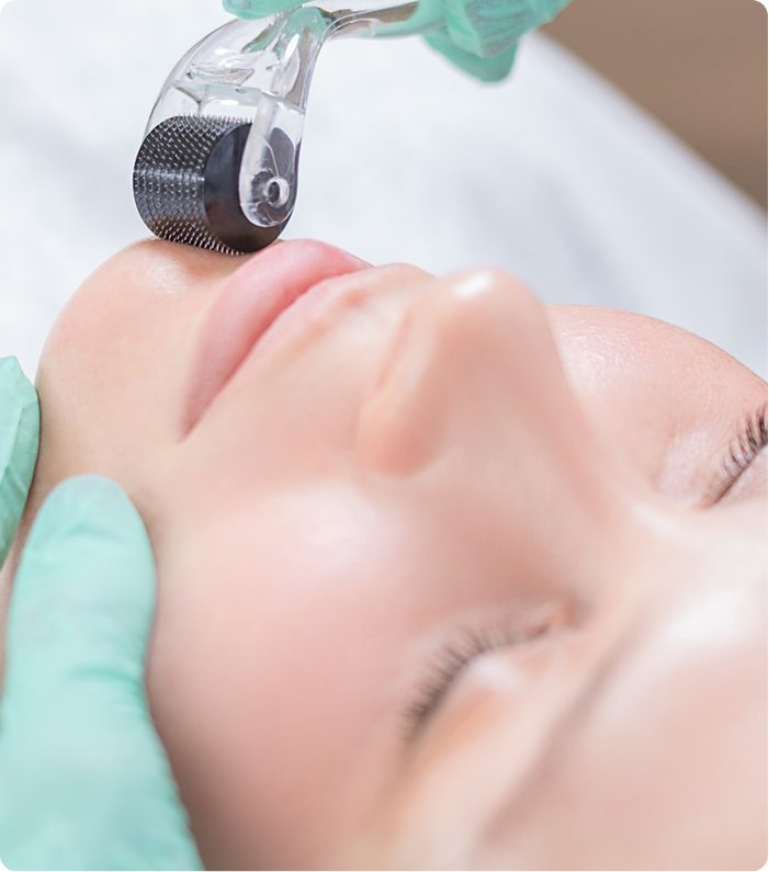 Collagen Induction Therapy