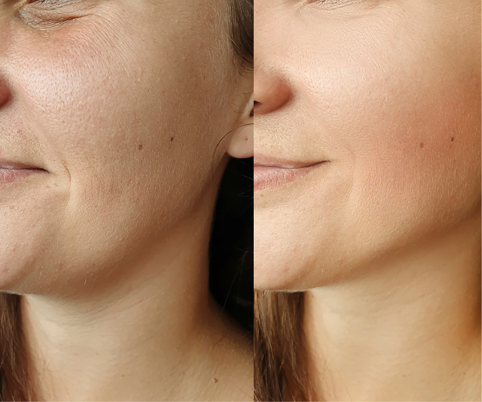 Treatment Planning Results