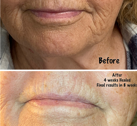 Real Clients, Real Results