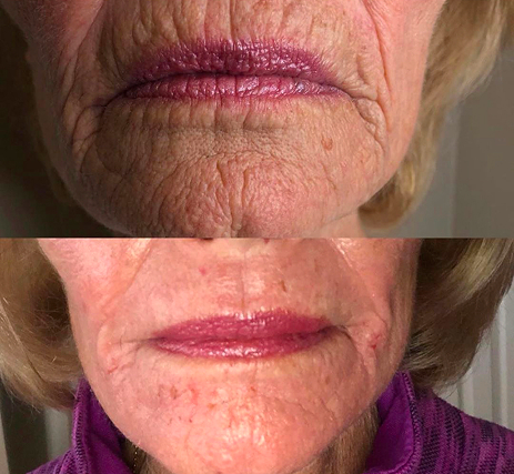 Real Clients, Real Results