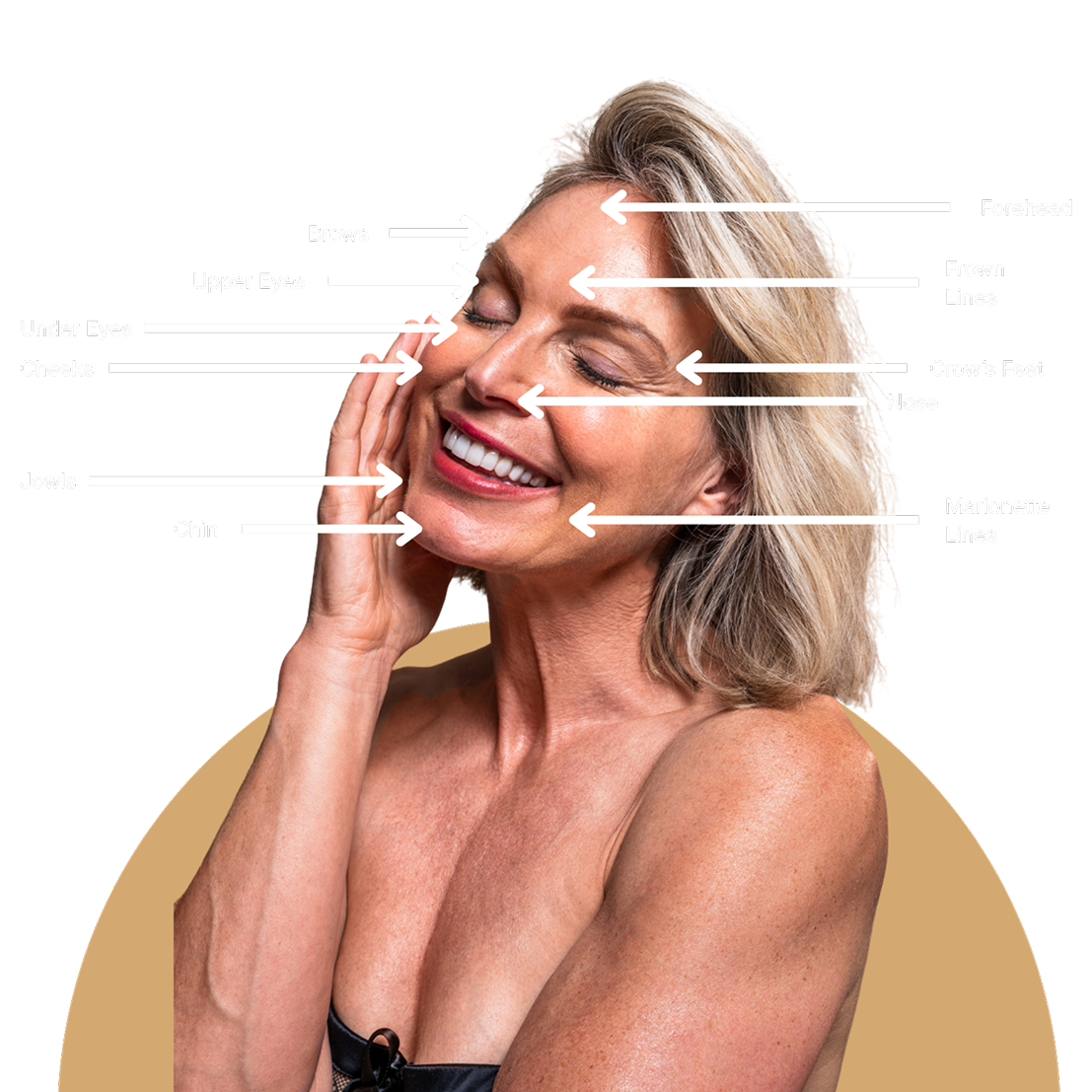 Areas Treated | Face