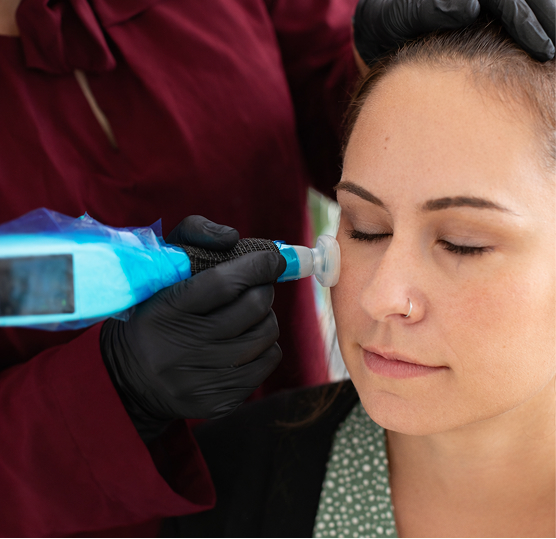 Structural Collagen Renewal Without Surface Trauma